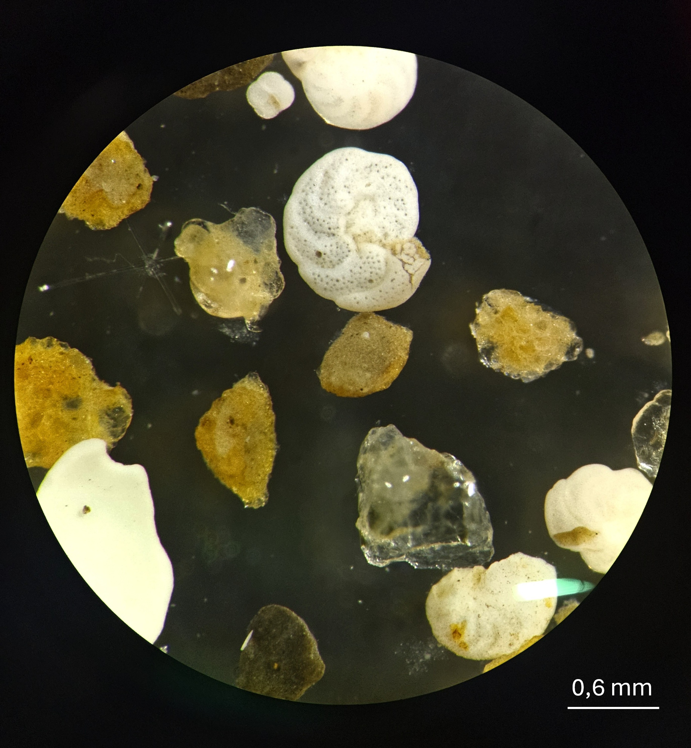 Popcorn-like shells and brown slime creatures under the microscope.