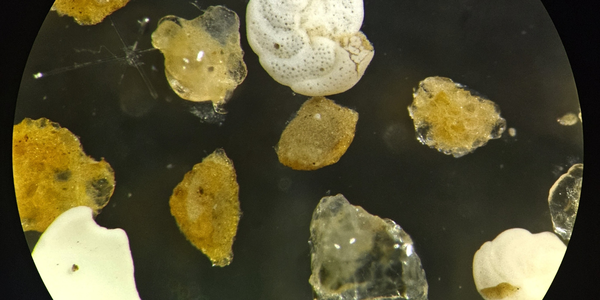 Popcorn-like shells and brown slime creatures under the microscope.