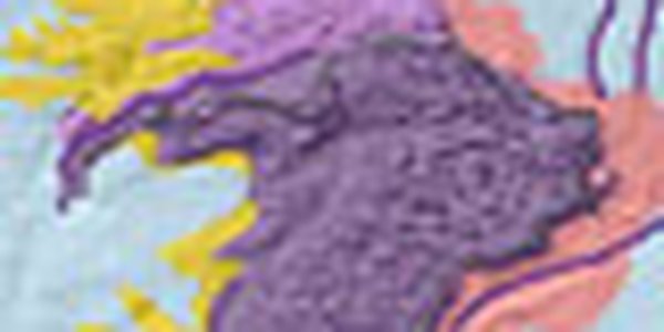 page thumb 9312